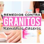 Cómo quitar granitos de la cara - Remedios caseros y tratamientos
